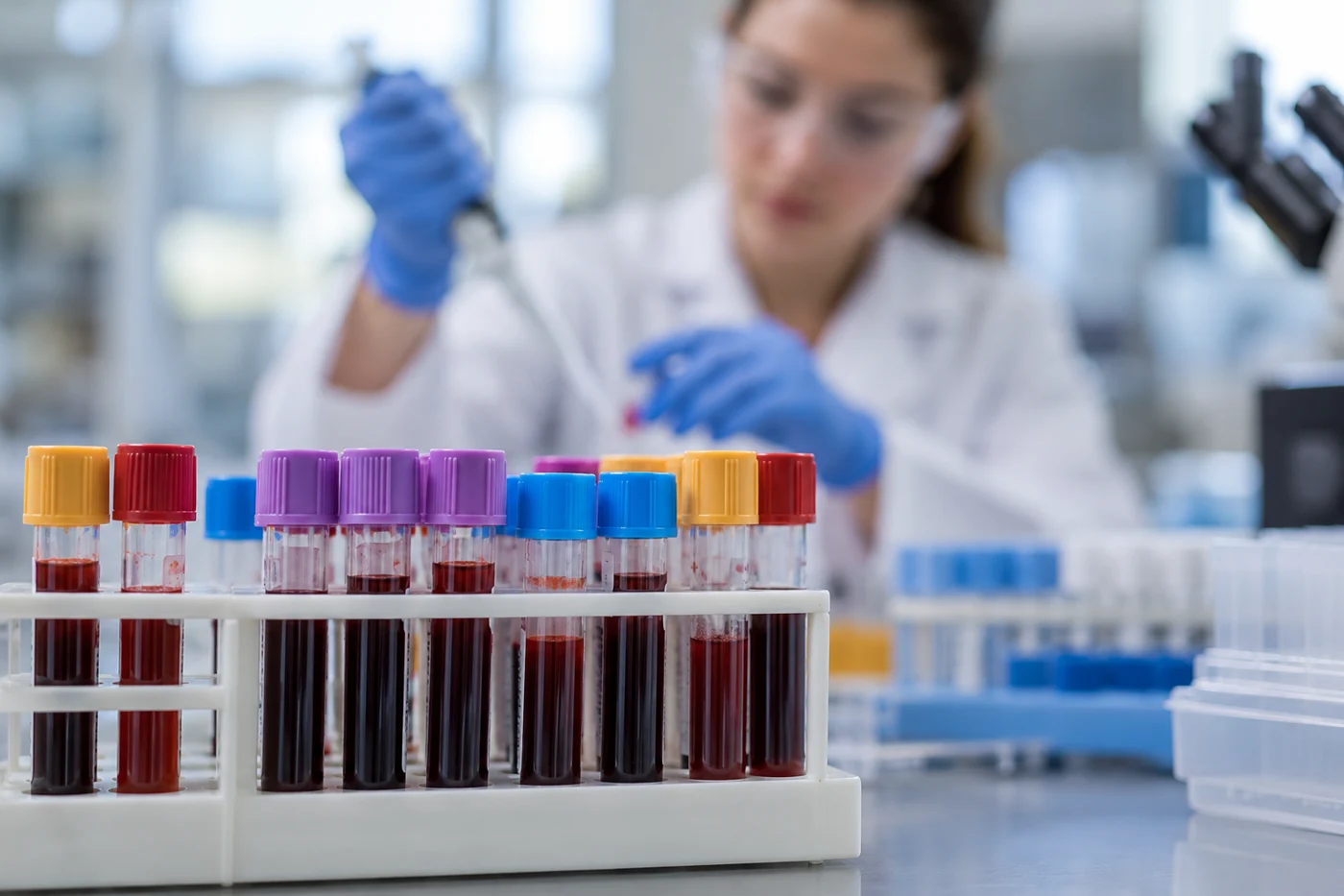 Laboratory still-life of capped blood collection tubes in a rack and a softly blurred laboratory technician behind, no legible labels. Illustrative editorial image.